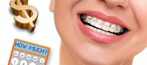 میانگین تعرفه ارتودنسی در سال ۱۴۰۴
