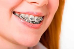 چرا ارتودنسی در ایران؟