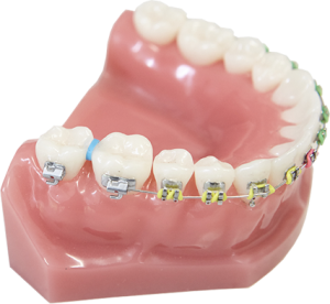با درد ناشی از سپراتورها چه باید کرد؟