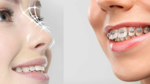 ارتودنسی و بینی چه ارتباطی با هم دارند؟