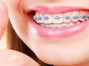آیا ارتودنسی در این دوران مضر است؟