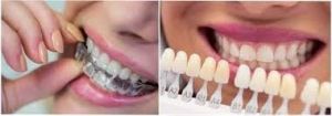 چه کسی کاندیدای ایده ال برای الاینرهای شفاف است؟