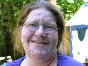 نوروفیبروما چیست و چرا برای ارتودنسی مهم است؟