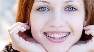 از دیدگاه یک متخصص ارتودنسی با تجربه