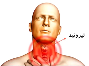 کمکاری تیروئید چیست و چرا اهمیت دارد؟