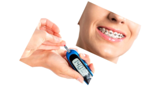 ارتودنسی و دیابت | آیا امکان‌پذیر است؟