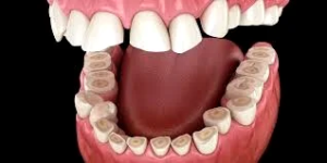 علل بروز دندان قروچه